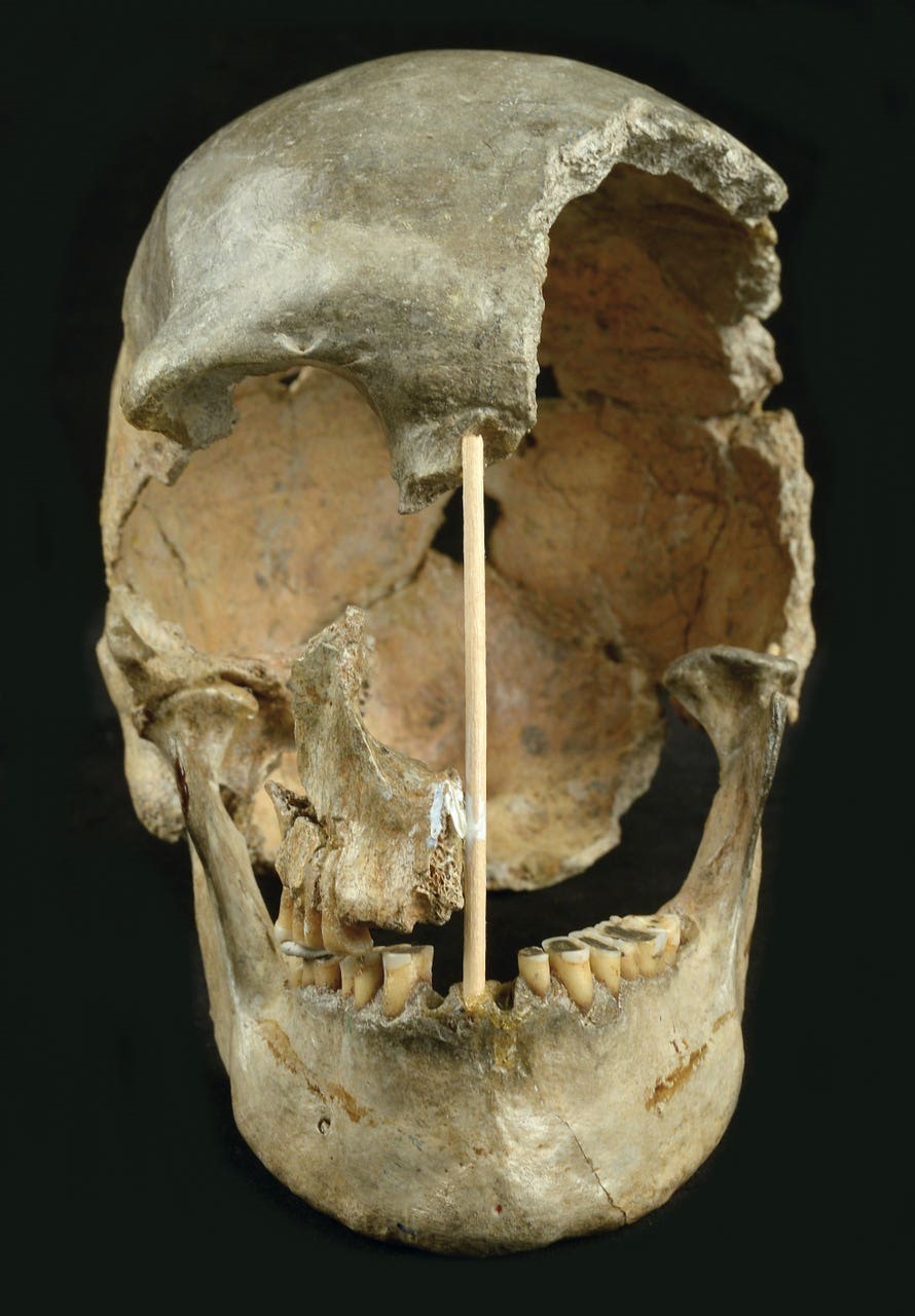 Sự thật về hộp sọ 14.000 năm của nàng Eve nước Anh